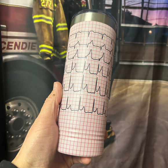 STEMI Tumbler